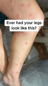 13K views · 3.8K reactions | Darwin locals reveal the mozzie...