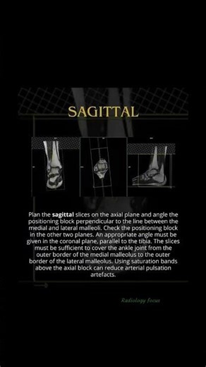 MRI Ankle AND Axial, Coronal, and Sagittal Planes