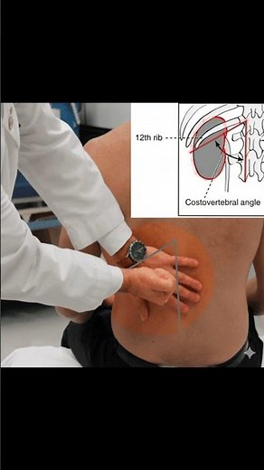 Costovertebral Angle (CVA) Explained #physicalexam #meded #ATC #physiotherapist #emergencymedicine
