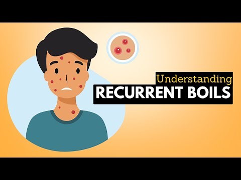 How to Recognize Boils