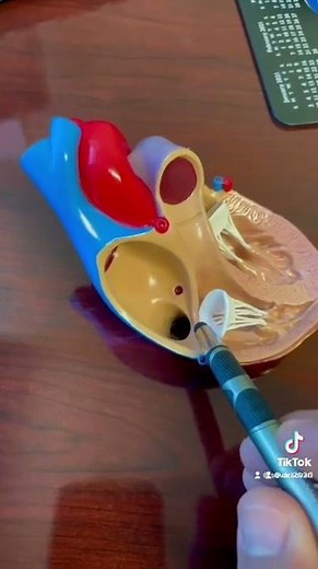 Catheter ablation for atrial flutter