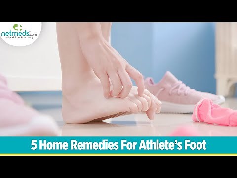 Athlete's Foot: 5 Amazing Home Remedies For This Fungal Infection