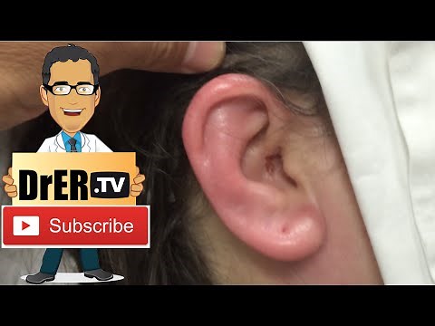 infection of the ear