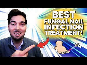How to Get Rid of Nail Fungus