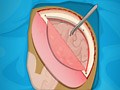 Operate Now: Epilepsy Surgery 🕹️ Online Game | Gameflare.com