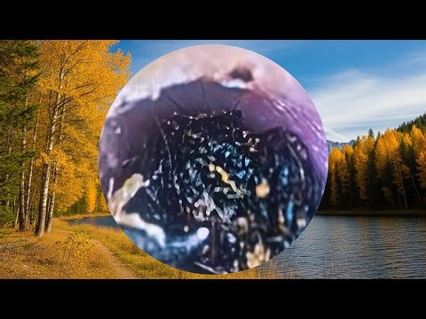 Hard & Impacted Ear Wax Removal | Satisfying Video