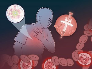 7.5K views · 64 reactions | Some patients with chronic obstructive pulmonary disease have evidence of type 2 inflammation, including elevated blood eosinophil counts. Research findings on subcutaneous dupilumab in these patients are summarized in a new Quick Take video. https://nej.md/4dF7N06 | The New England Journal of Medicine | Facebook