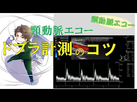 [Carotid Artery Ultrasound] Tips and points for Doppler measurements!