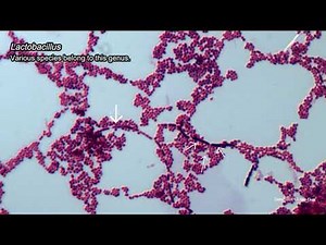 Tooth decay - A little peek at the bacteria causing caries under the microscope (4K)