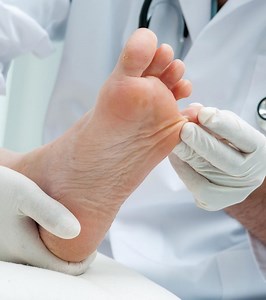 Athlete's Foot During Pregnancy: Causes And Home Remedies