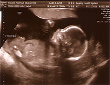 Online Ultrasound Tech Colleges