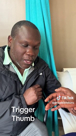 Dr. Ezekiel Oburu (@drezekieloburu) - Understanding and Treating Trigger Thumb: Options and Tips