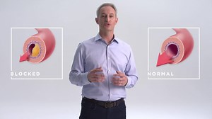 Take a minute to see how easy it is to get screened for Stroke and Cardiovascular Disease Risk. | Life Line Screening