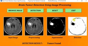 Brain Tumor Detection Using Image Processing Python Project With Source Code | IEEE Based Projects