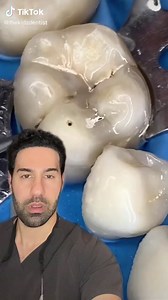 🥷 cavity! Stealth & 😈. Doesn’t look like much but watch & see how big this cavity is! It needs a root canal! #dentist #teeth #tooth #education #rootcanal teeth cleaning plaque removal calculus removal on teeth rotten teeth tooth decay extraction abscess tooth removal cavity infection hole in tooth toothpaste teeth implants teeth care
