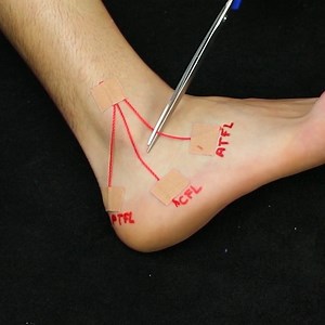 546K views · 3.8K reactions | Massage therapy sessions & taping techniques | Simple ideas | Facebook