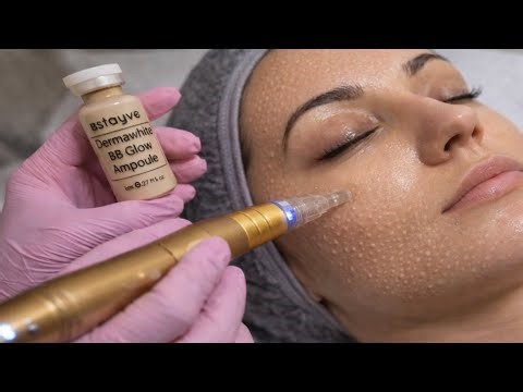 BB Glow Micro needling Treatment at home | Step by Step | Skin Glow Facial | Dr pen| dermapen facial