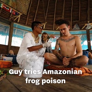 This guy tried the Amazonian healing medicine of ‘Kambo’ - where frog poison is burned into the skin and takes effect pretty drastically… | UNILAD