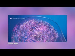 Alzheimer's drug development pipeline and Brainshuttle technology for drug targets in the brain