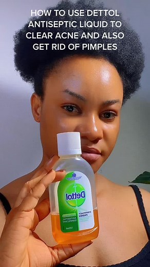 How to Use Dettol Antiseptic Liquid to Clear Acne and Pimples