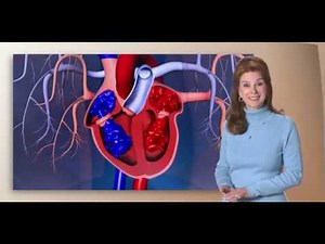 Ultrasound Hemodynamics & Doppler