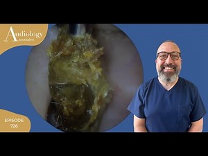 DRY EAR WAX & SKIN REMOVAL - EP726