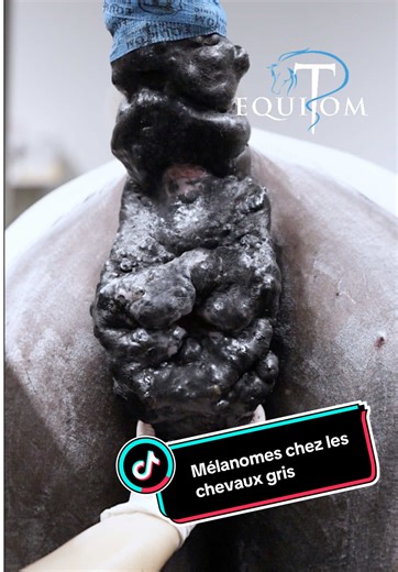 mélanomes chez les chevaux gris Malheureusement, de nombreux propriétaires pensent encore que les mélanomes chez le cheval ne peuvent pas être traités. Chez Equitom, nous souhaitons faire évoluer cette idée. Des solutions chirurgicales existent et, dans certains cas, elles peuvent s’avérer très efficaces. Dans le cas présenté ici, la tumeur a pu être retirée chirurgicalement, améliorant significativement le confort et la qualité de vie du cheval. Dans les prochains jours, nous partagerons une in