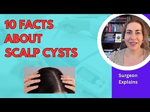 Scalp Cysts: Everything You Need To Know