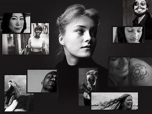 Potenza - Cynosure Lutronic Canada