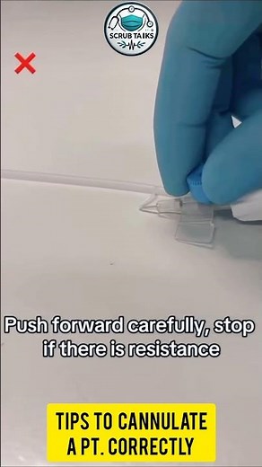 tips to cannulate a patient correctly