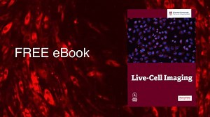 Learn the basics of live cell imaging with this free eBook | Molecular Probes