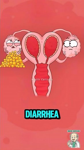 The RAREST Twin Pregnancy Explained #animation #twins #pregnancy