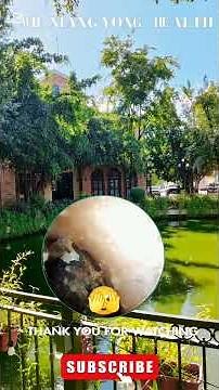 Earwax Build-Up Clean: A Simple Guide to Relief and Prevention#23