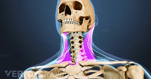 Neck Strain: Causes and Remedies