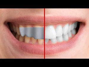 40 Duct Tape Hacks You Didn't Know About (Try #28 Now!)