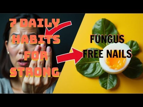 7 Daily Habits to Keep Your Nails Strong and Fungus-Free | Nail Care & Treatment Tips video