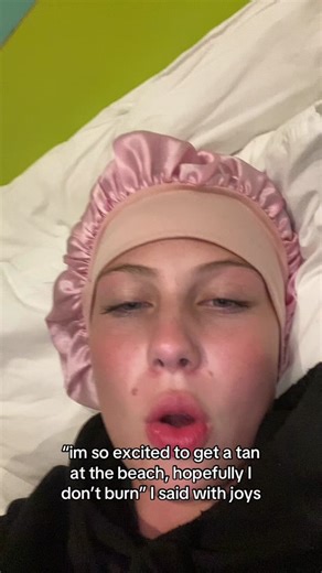 Avoiding Sunburn: My Beach Experience and Lessons