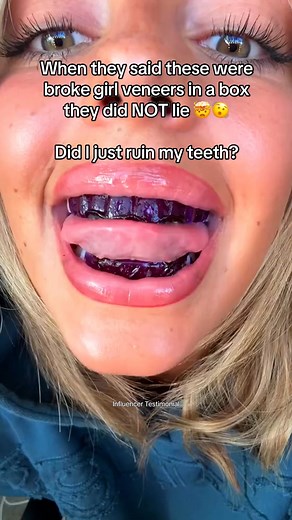 9.3K views |  Claim 3 FREE Gifts Now   Every order comes with 3 FREE gifts. ✨ Plus, 3 lucky customers each day in each region will find our Electric Toothbrush in their order… completely FREE. Don’t miss your chance  3 free gifts - T&C's apply, only at hismileteeth.com | Hismile | Facebook