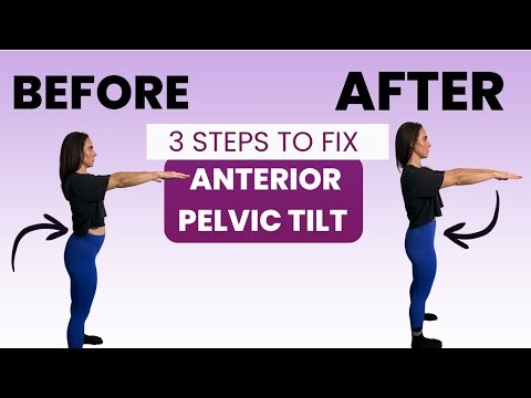 Fixing Anterior Pelvic Tilt (ATP): Why Your Hips + Back Feel Tight