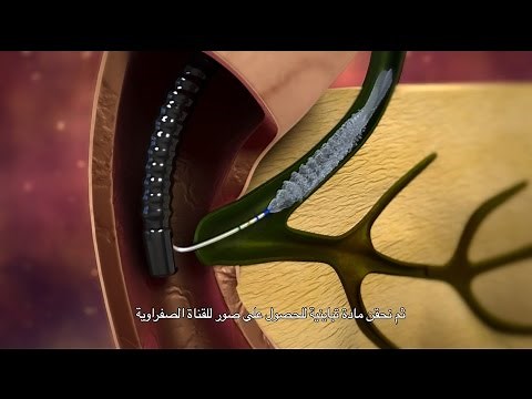 Imaging of Bile Duct and/or Pancreas