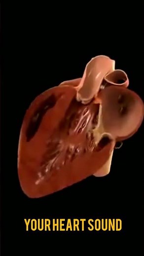 HEART BEAT SOUND | ANATOMY OF HEART | Understanding Heart Murmurs | #Cardiologist #HeartSounds