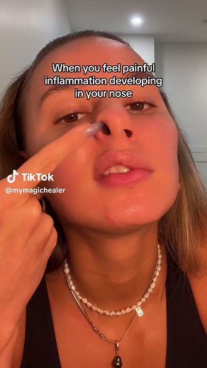 How to Heal a Growing Pimple on Nose Before Infection - Tips & Remedies