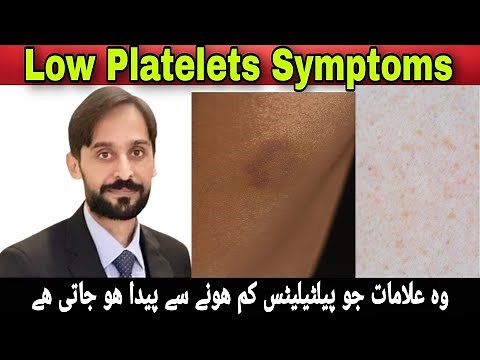 Symptoms of Low Platelet Count