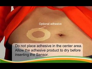 Dexcom G4 PLATINUM (Pediatric): Inserting Your Sensor
