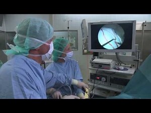 Krebs operieren: Schlüssellochchirurgie (MIC) bei Vivantes