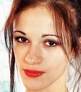 How To Get Rid Of Dark Spots On Face: 6 Proven Natural Remedies