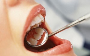 Bupa dental insurance opens up to virtual oral care and extra benefits