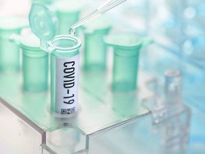 9.7K views · 33 reactions | India's Corona count mounts to 1,73,763, as 7,964 new cases come up in last 24 hours https://bit.ly/2AkhKC4 | The Economic Times | Facebook