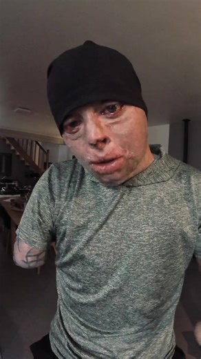 Soutien aux victimes d'incendie à Crans Montana