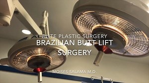 BBL Surgery Step by Step